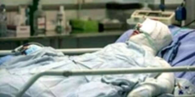۴۶ درصد مصدومان حوادث چهارشنبه سوری، رده سنی ۶ تا ۱۸ سال هستند