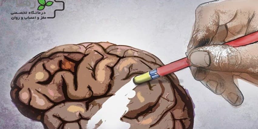 مشکل در راه رفتن نشانه اولیه بیماری آلزایمر است